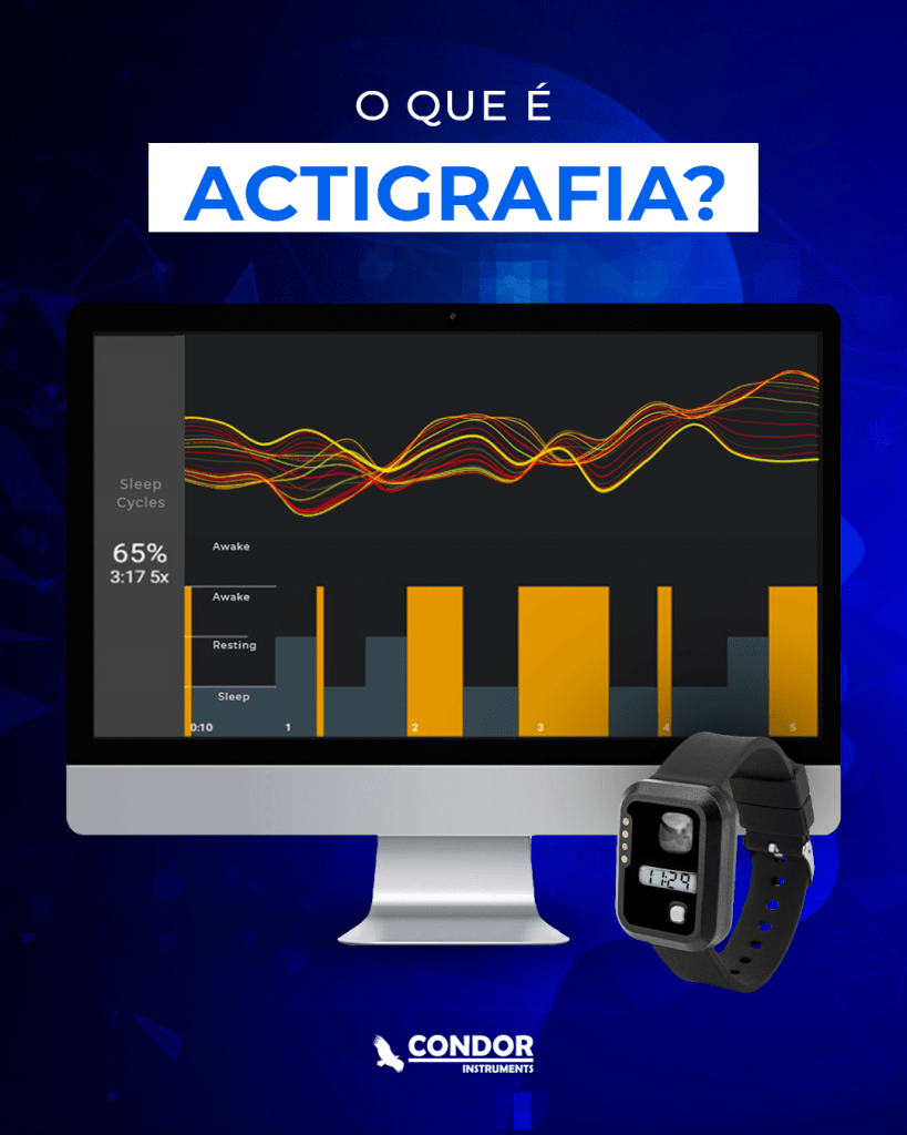 actígrafo