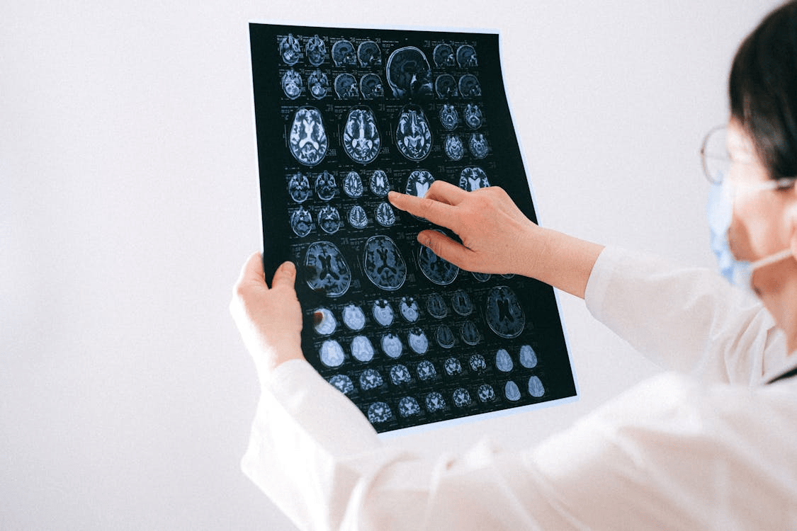 A researcher holding a brain scan